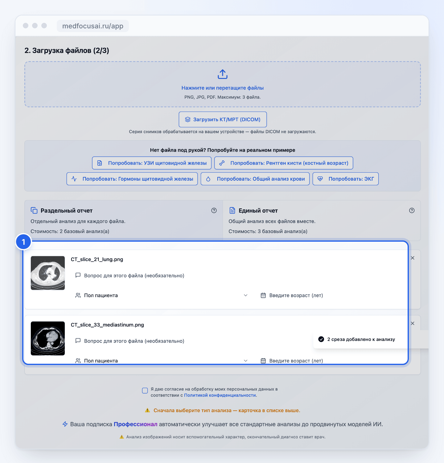 Два среза КТ в списке файлов анализа